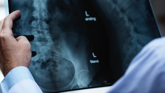 Megverte a mesterséges intelligencia az orvosokat egy diagnosztikai vizsgán
