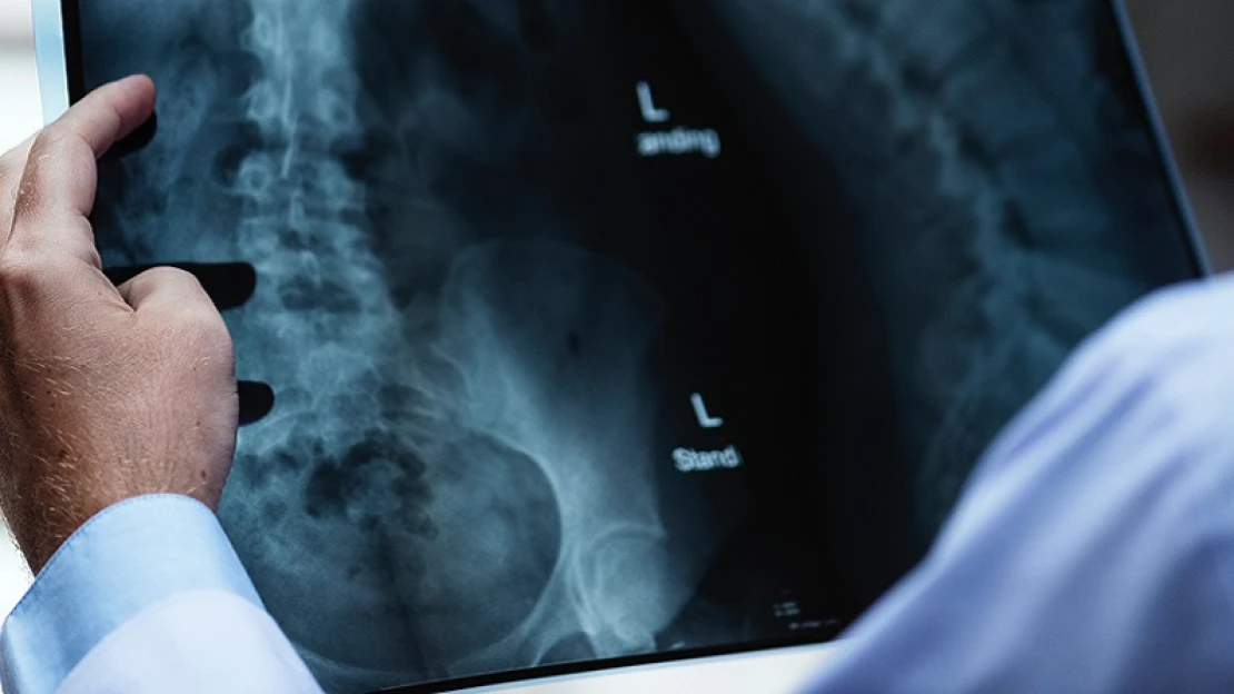 Megverte a mesterséges intelligencia az orvosokat egy diagnosztikai vizsgán