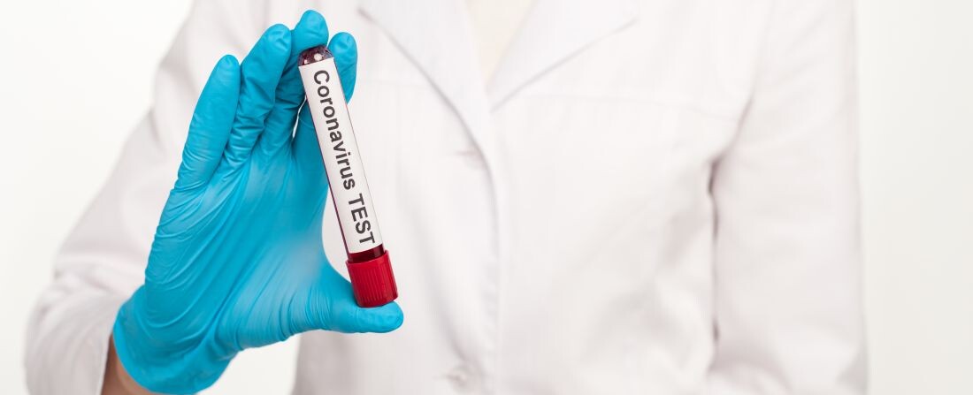 Világújdonság koronavírus-tesztet fejlesztettek ki szegedi kutatók