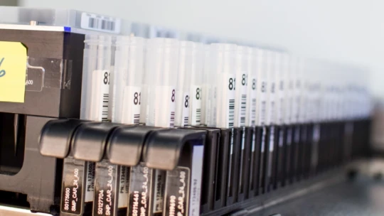 14 ezer PCR-tesztből két pozitív eset eddig a budapesti Eb-n