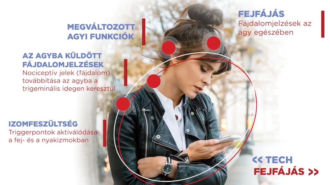Fejfájással fizetjük meg a stressz és a kütyühasználat árát